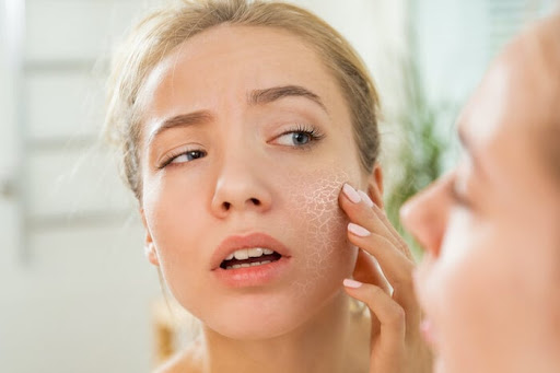 Quy trình chăm sóc da mặt khô đơn giản, hiệu quả tại nhà